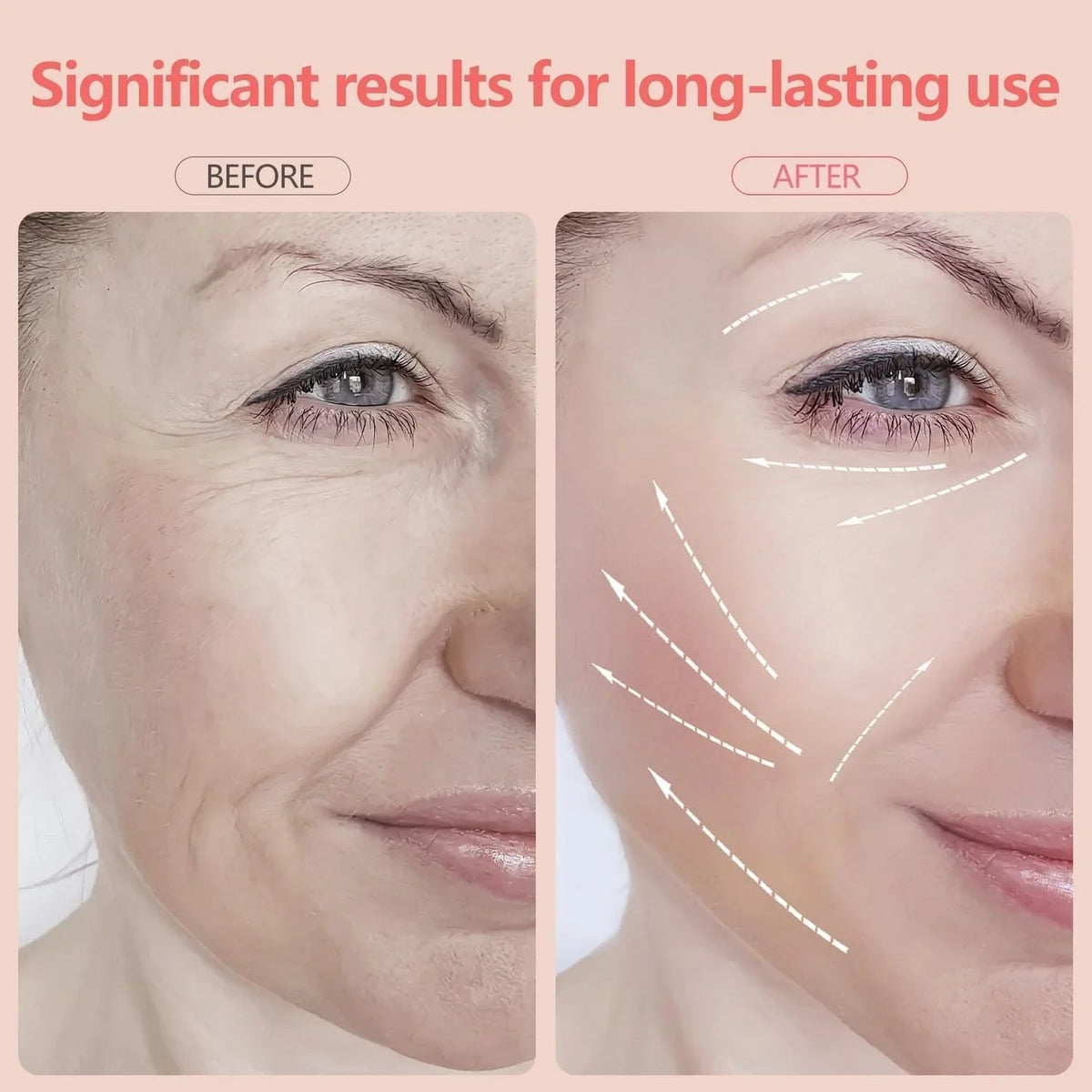 Contour™ 7 LED Light & EMS Sculpting Wand
